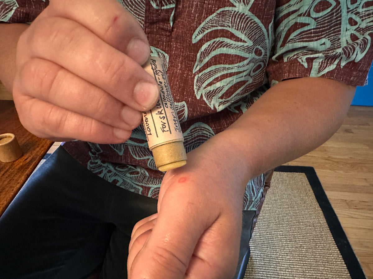 Person applying skin salve stick to a small burn on their hand with a patterned shirt in the background