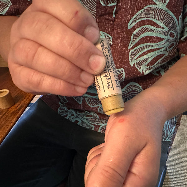 Person applying skin salve stick to a small burn on their hand with a patterned shirt in the background